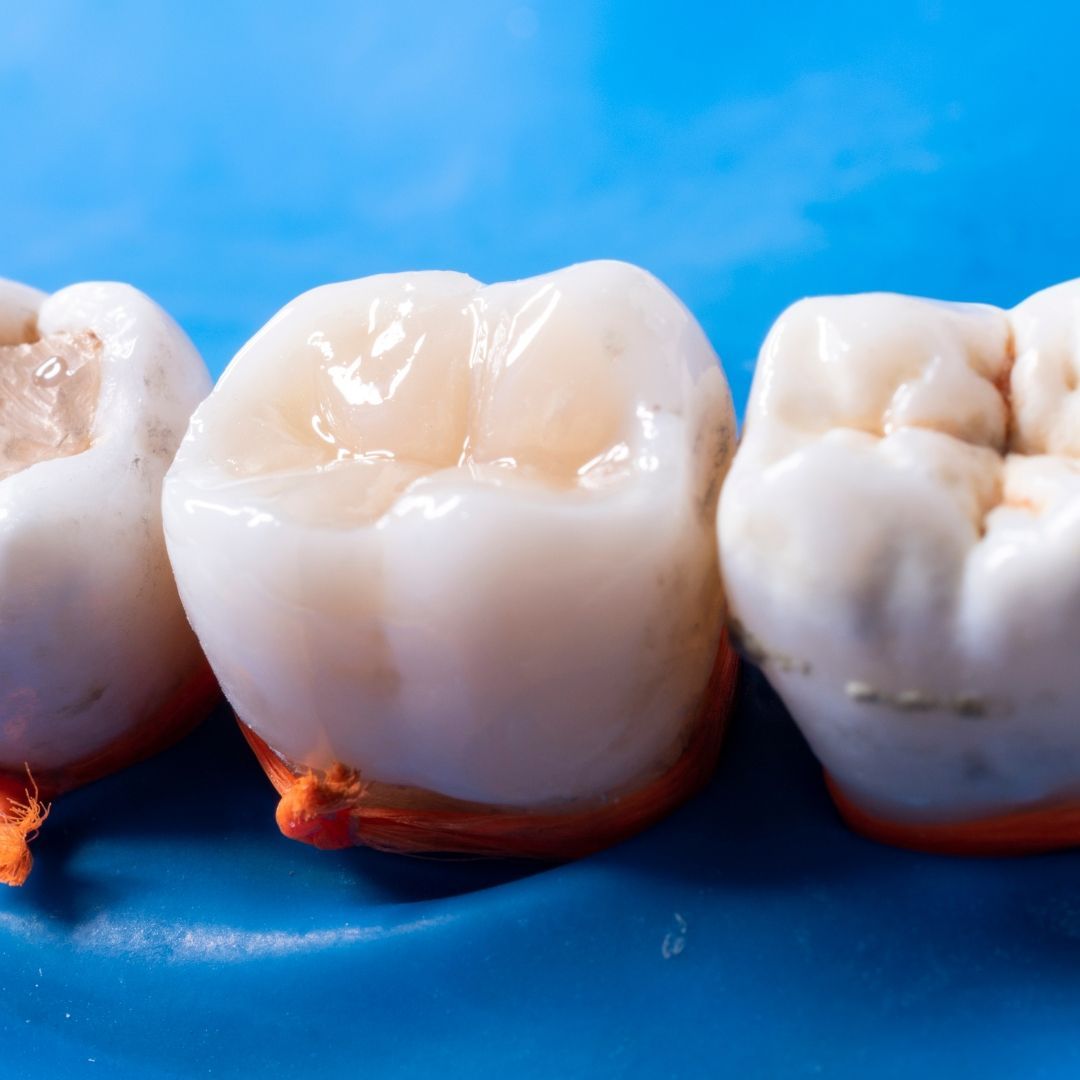 Three dental crowns with light-colored enamel, sitting on an orange rubber dam against a blue background.