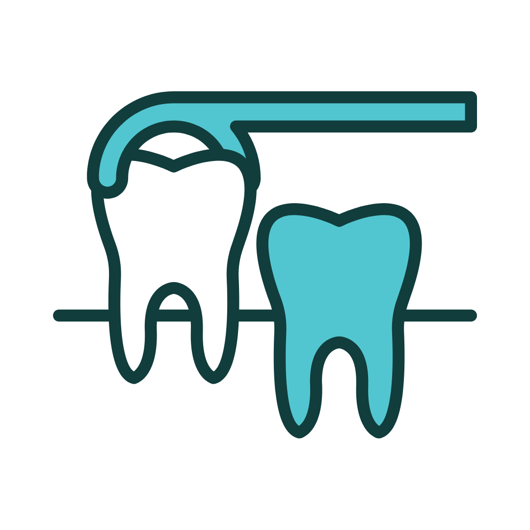 Outline of a white mouthguard, showing the inside and outside.