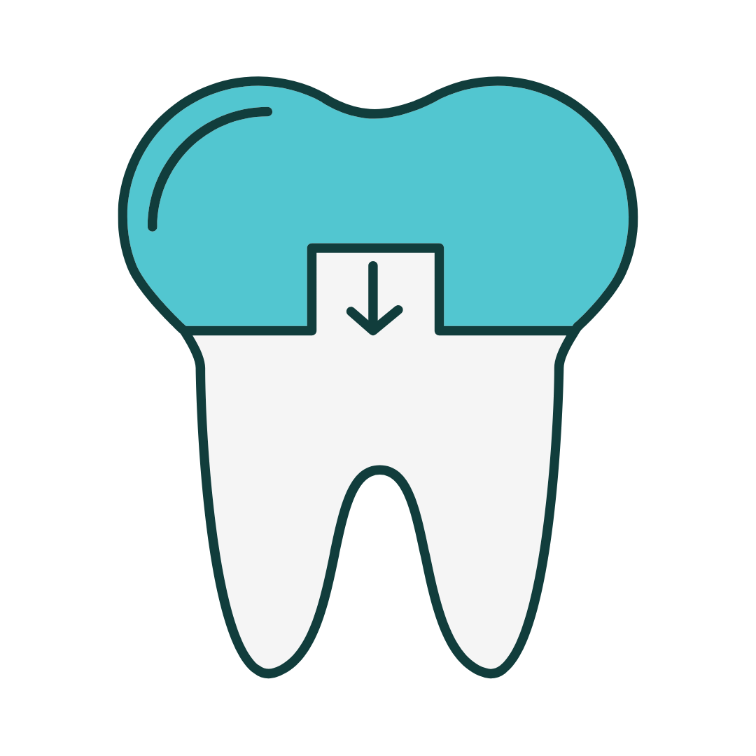 Tooth being brushed with turquoise toothbrush and toothpaste, showing a sparkly clean effect.