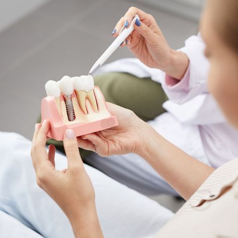 A dentist holding a model of teeth, pointing to a dental implant with a pen to explain it to the patient.