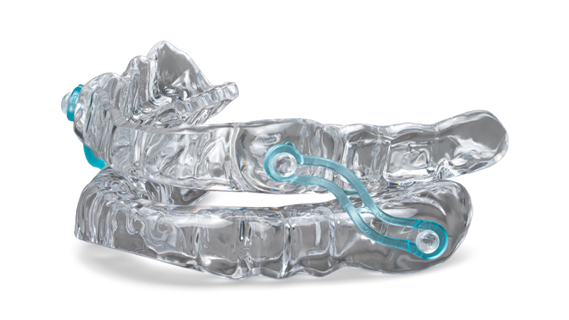 Clear oral appliance with turquoise connector for treating sleep apnea.