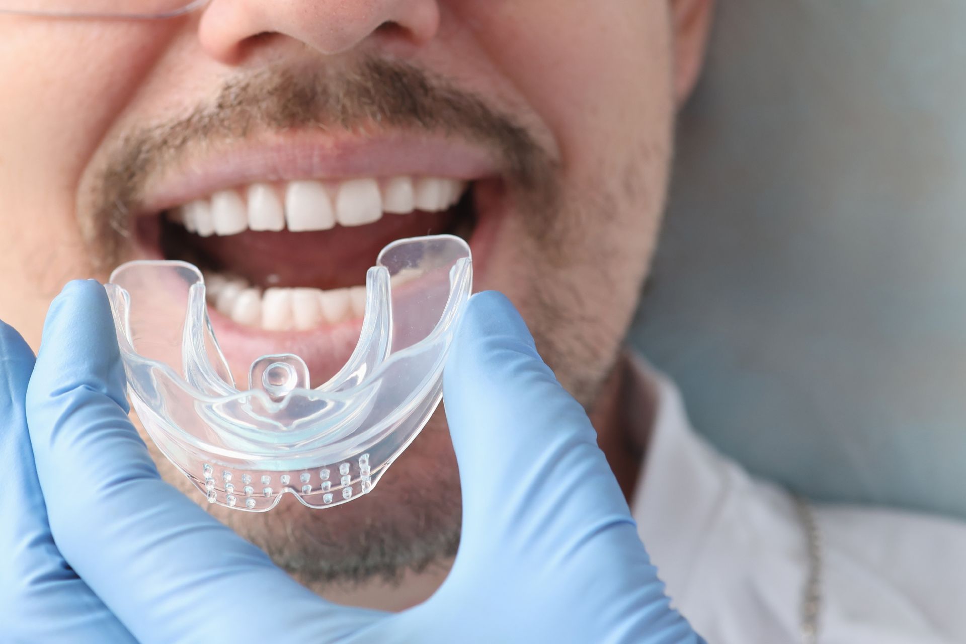 A person with open mouth, holding a clear mouthguard, presumably for teeth whitening. They have a mustache, and the person is wearing blue gloves.