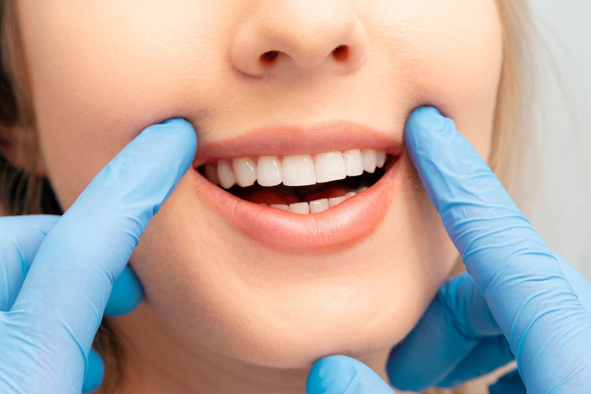 Close-up of a woman's smile, with gloved hands pulling back her cheeks to show her teeth.