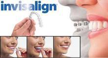 invisalign logo with woman wearing braces and showing the positive effects of the device
