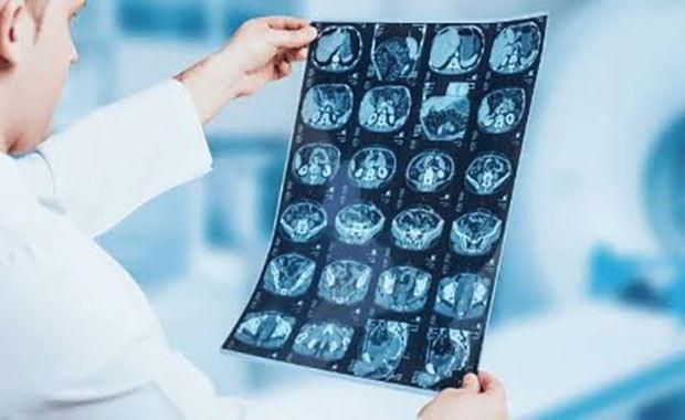 DR. JUAN MANUEL AGUILAR MELCHOR ONCÓLOGO