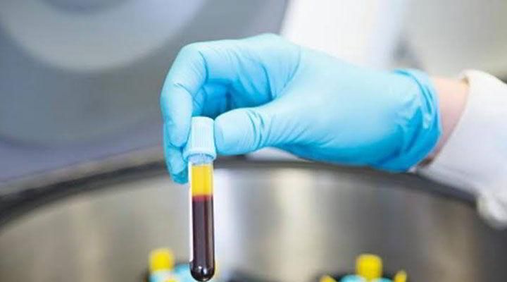 DR. JUAN MANUEL AGUILAR MELCHOR ONCÓLOGO