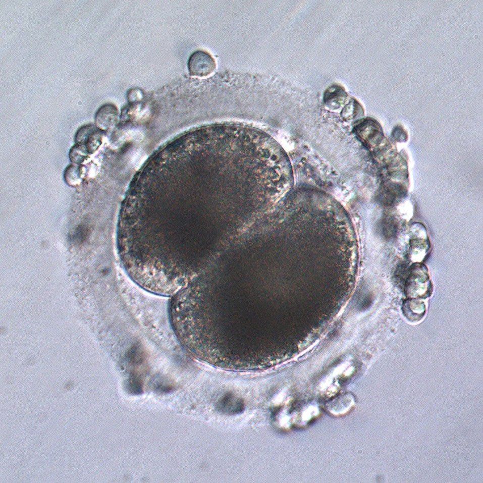 Two cell ICSI embryo, 24 hours following sperm injection. Several cumulus cells remain on the surface of the zona pellucida in this embryo.