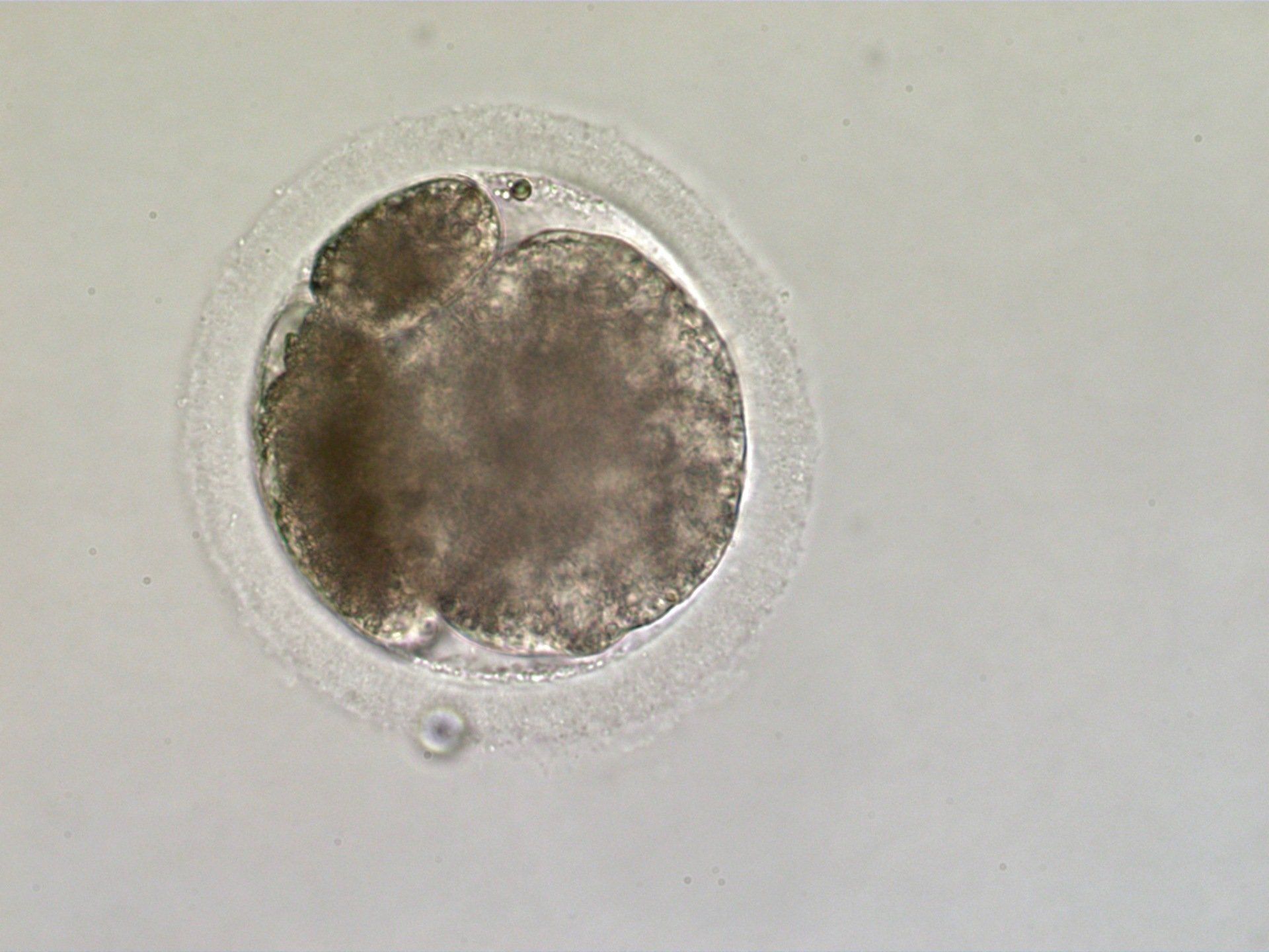 Compact morula, day 5 following ICSI. At about day 5 embryos undergo compaction where the relatively autonomous cells coalesce to become a single tissue-like mass.