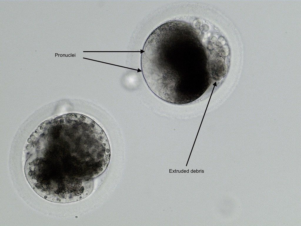One 2 cell embryo and 1 fertilized oocyte 24 hours following fertilization. Both exhibit extruded debris commonly expelled from the oocyte a few hours prior to the first cell division.