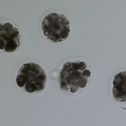 Day 4 ICSI embryos of varying quality.