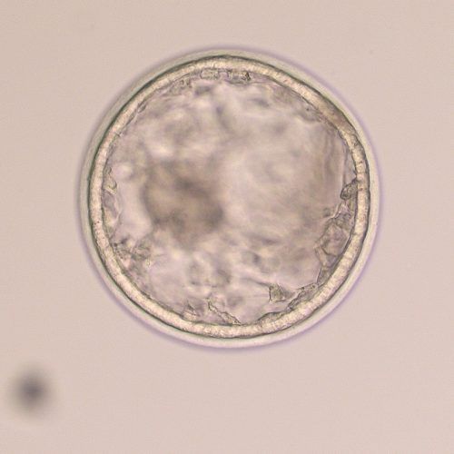 Grade 1 expanded blastocsyt showing the hypoblast cell layer migrating inside the trophoblast layer.