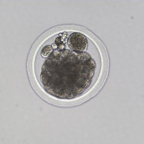 Grade 2 compact morula.