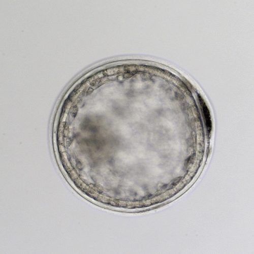 Grade 1 expanded blastocyst with a prominent capsule beneath a thinning zona highlighted by the extruded blastomeres trapped between the layers.