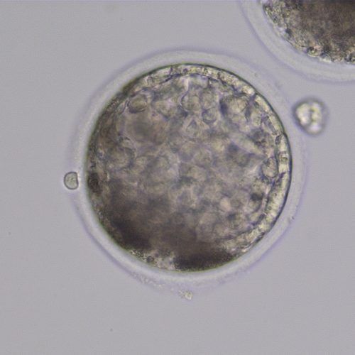 ICSI early blatocyst 7 days following ICSI. The trophoblast layer has become evident on the periphery of the blastocyst.