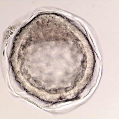 Grade 3 expanded blastocyst, shrunken with damaged capsule and leakage from the blastocoele.