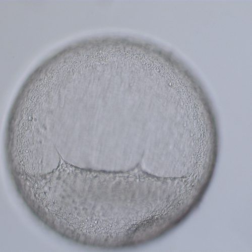 Grade 2.5 large expanded blastocyst with the hypoblast layer partially avulsed from the trophoblast layer during shipment.