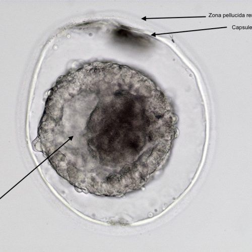 Grade 2.5 to 3 expanded blastocyst. There has been significant leakage of fluid from the blastocoele but the capsule remains relatively intact.