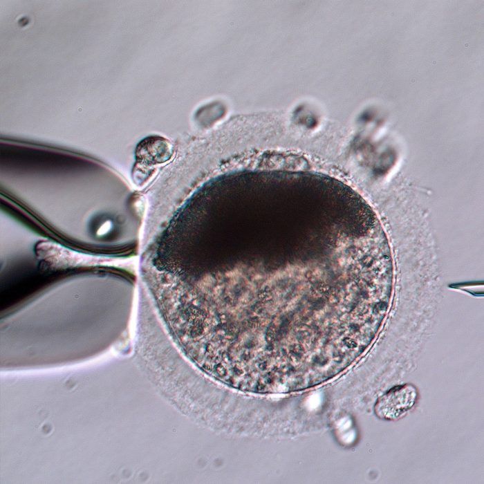 Intracytoplasmic Sperm Injection (ISCI) laboratory
