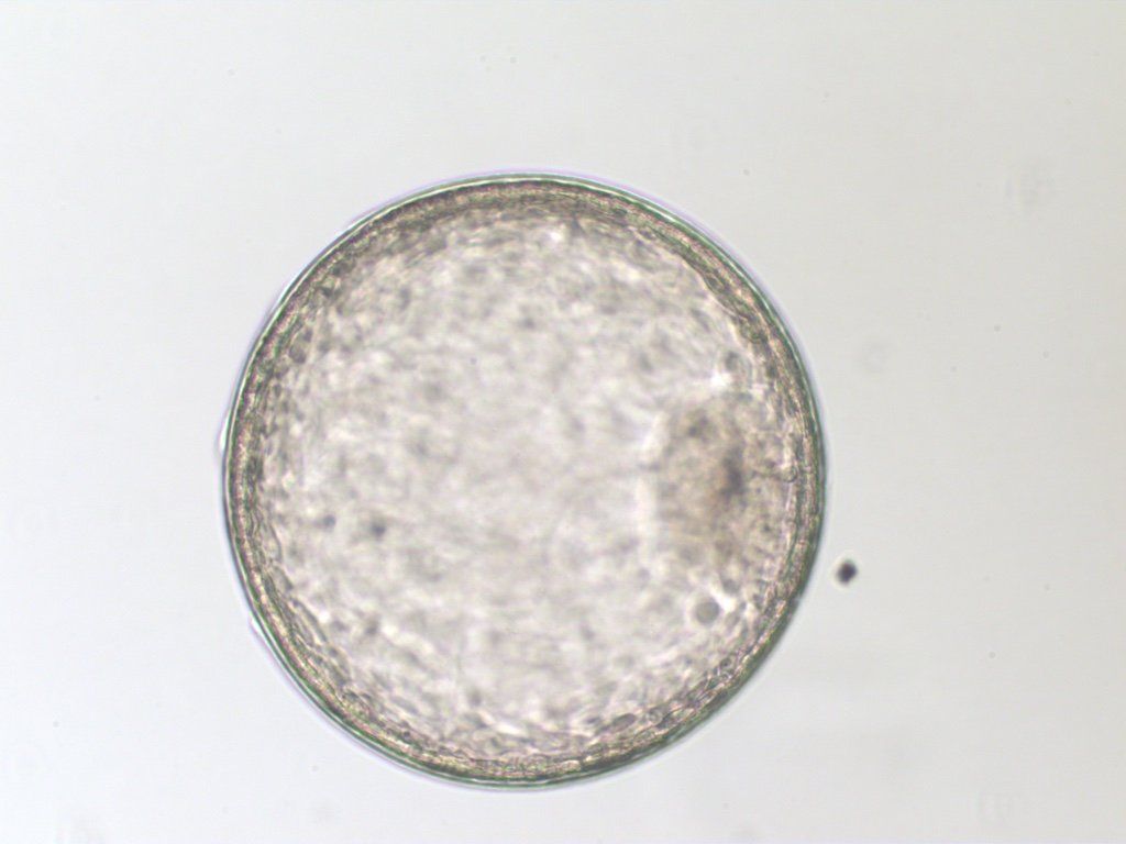 Grade 1 large expanded blastocyst