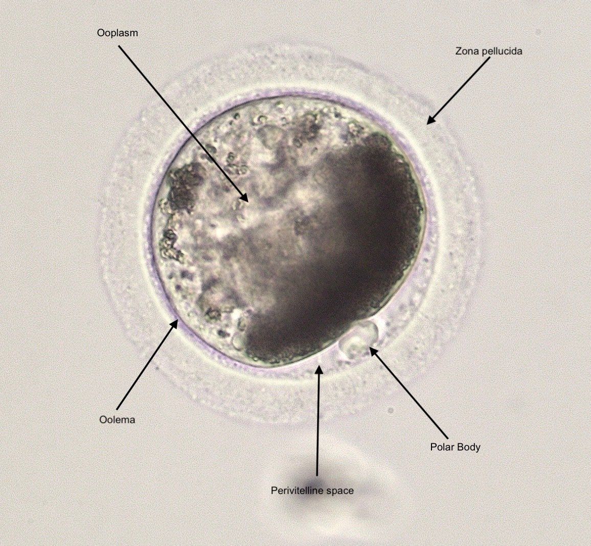 A mature oocyte at metaphase II, evidenced by the single polar body.