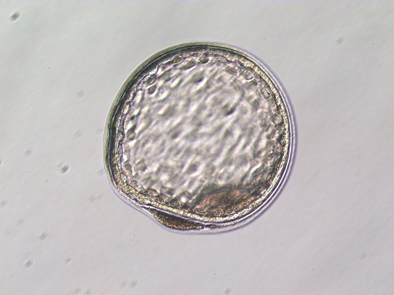 Embryo Transfer