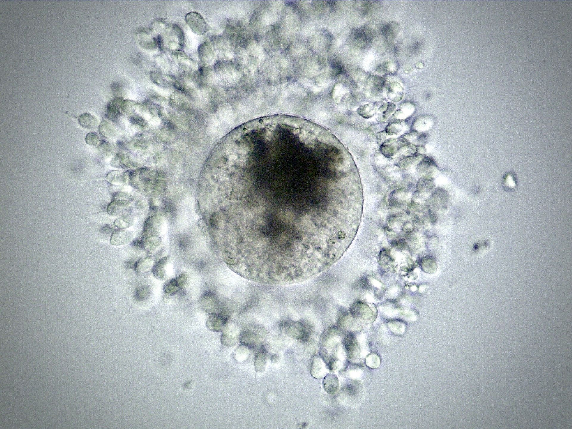 Oocytes (eggs) are collected from follicles on the ovaries by transvaginal follicular aspiration (TVA), also called ovum pickup (OPU).