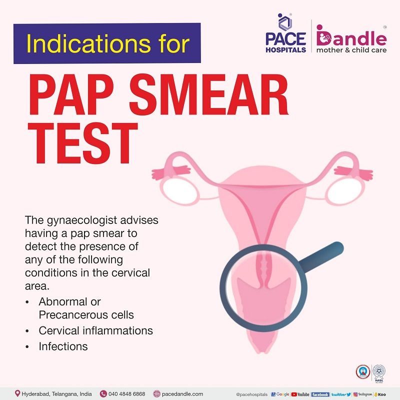 Pap Smear Test After 30 Years Preparation And Procedure