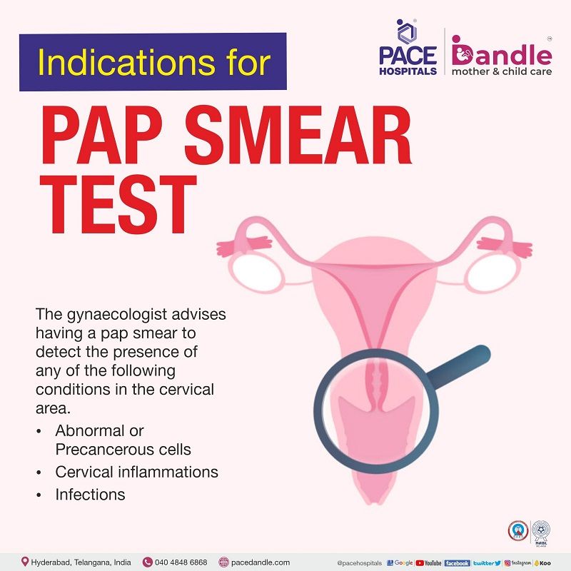 PAP Smear Test After 30 Years Preparation Procedure