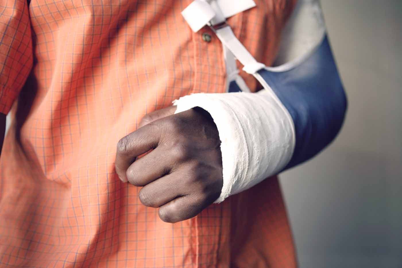 A man with a cast on his arm is wearing an orange shirt.