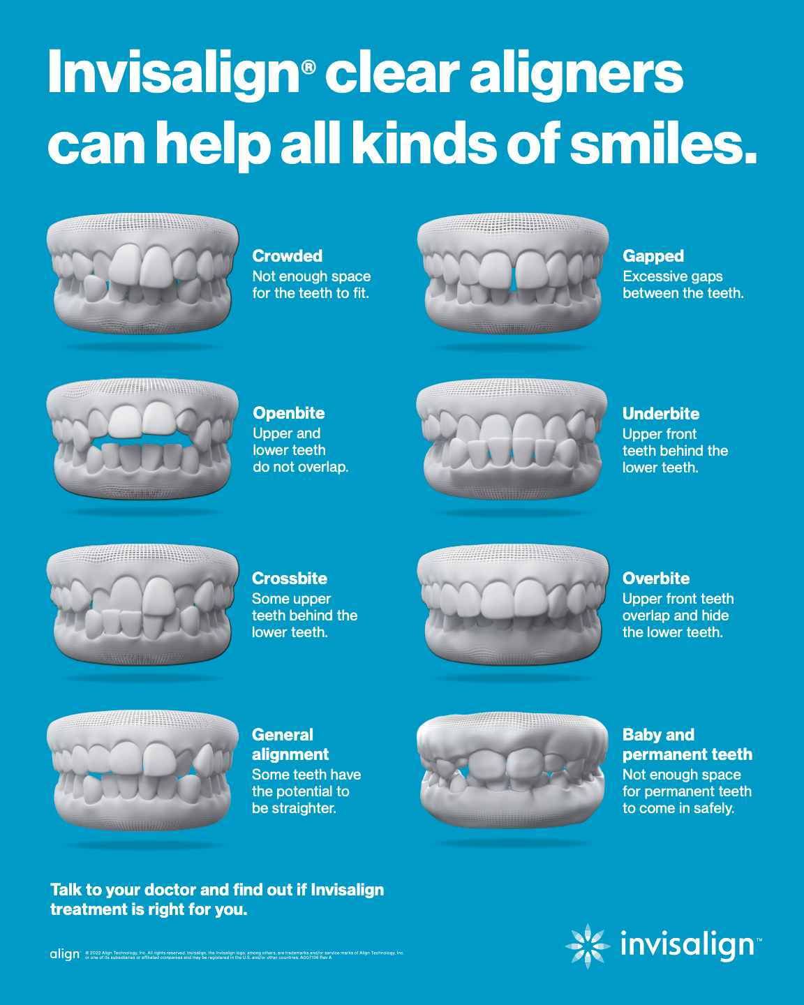 Invisalign Poster