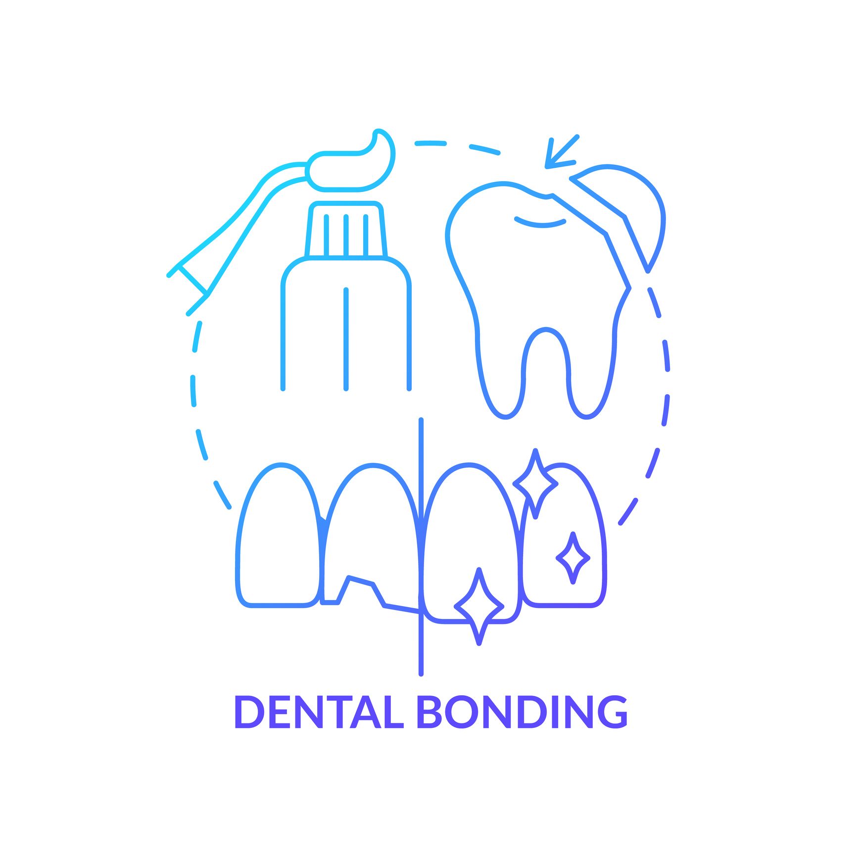 Cosmetic Dental Bonding