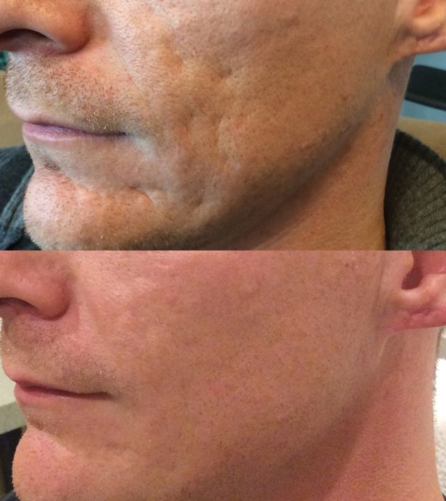 Laser Hair Removal, Cosmetic Injectables, Skincare Rejuvenation, Jacksonville, FL