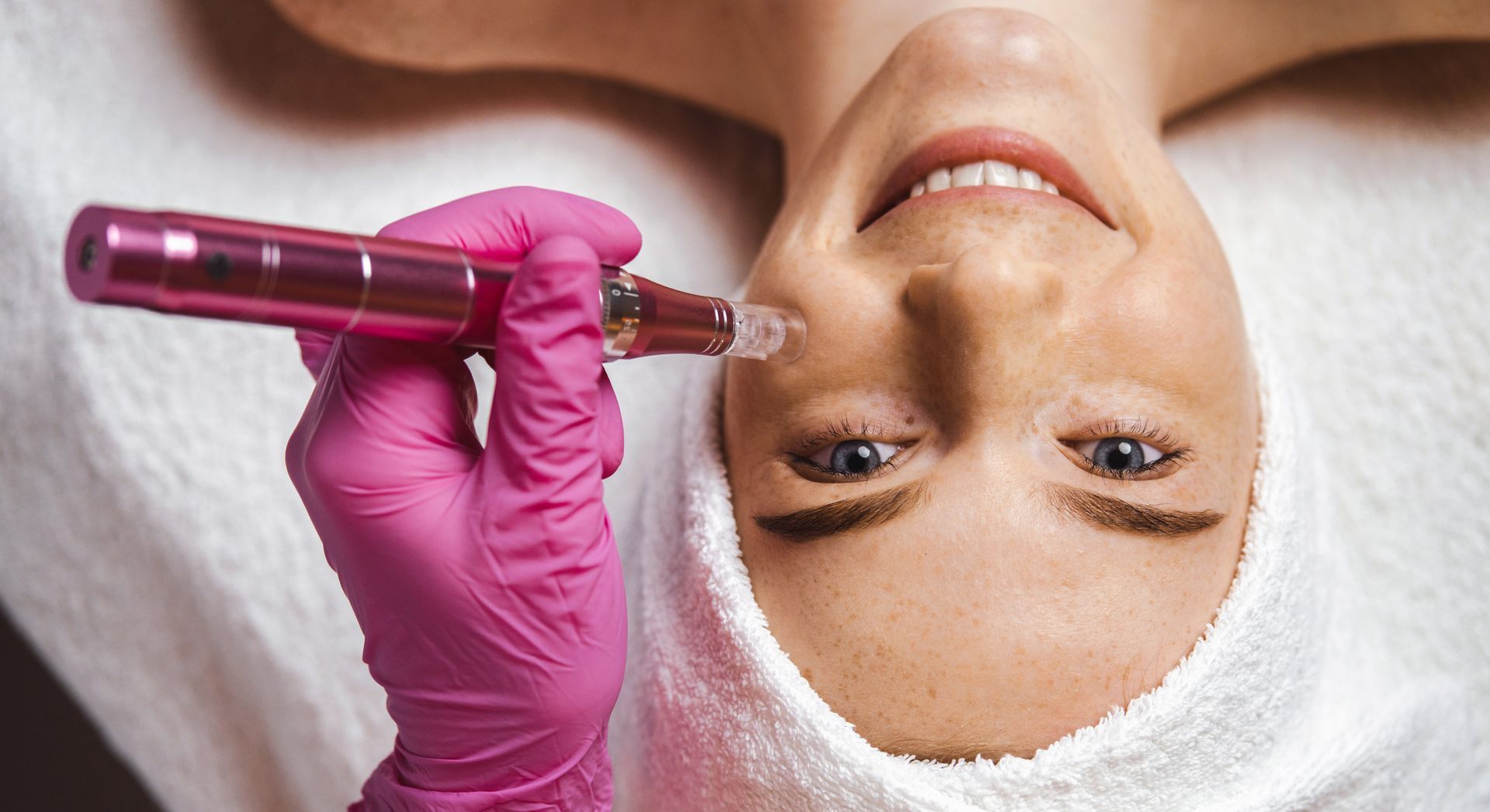 Close-up of a woman receiving a facial treatment with a microneedling pen.