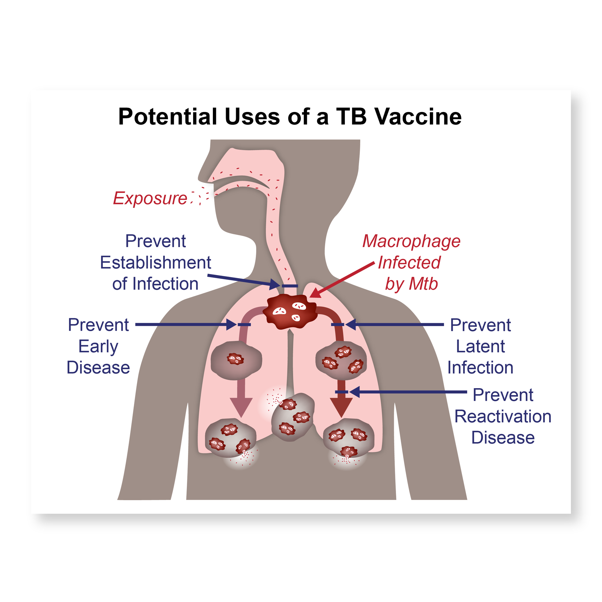 Scientific illustration of tuberculosis vaccine uses