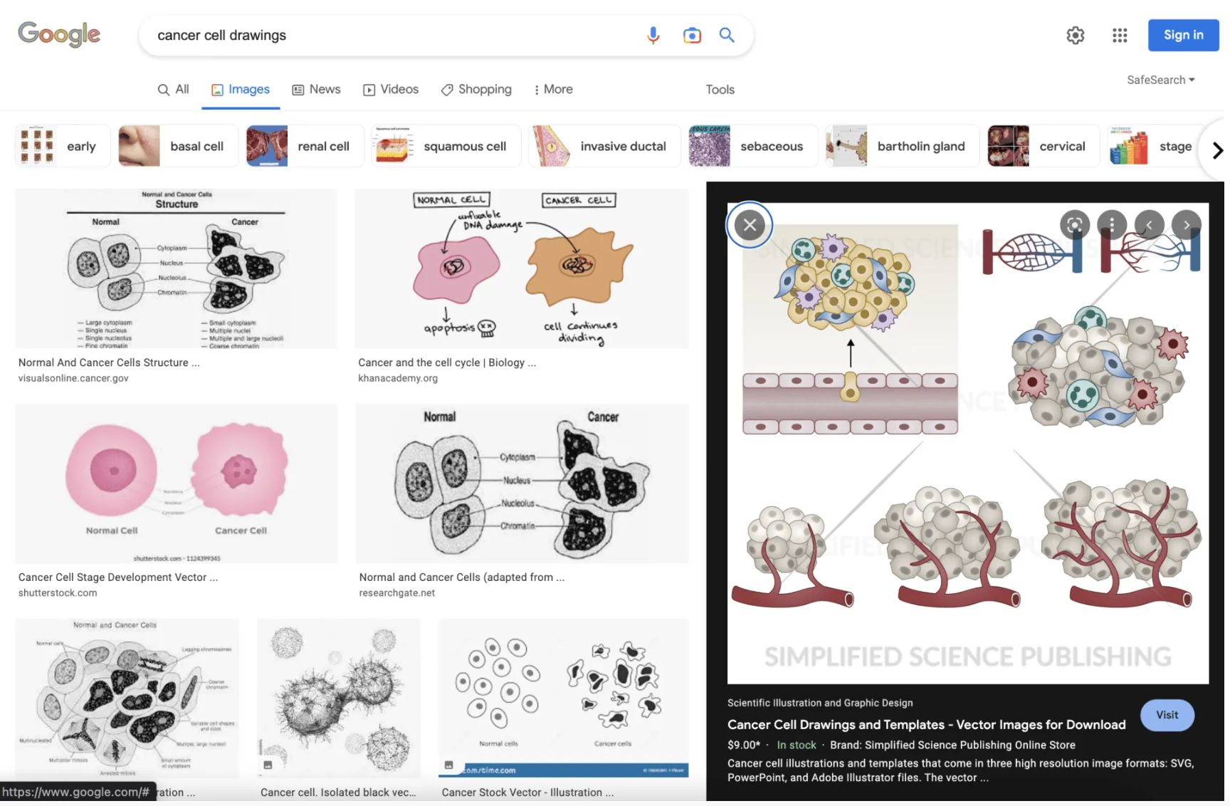 Screenshot Google example of cancer cell drawings