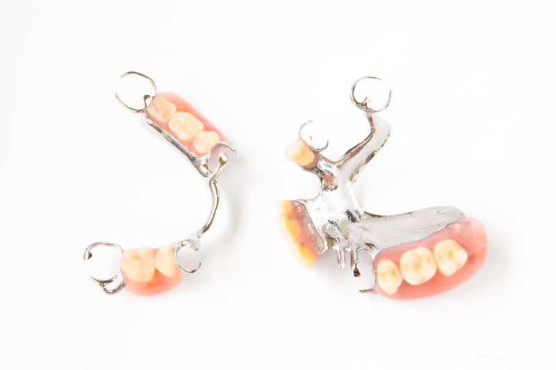 Metal Dentures