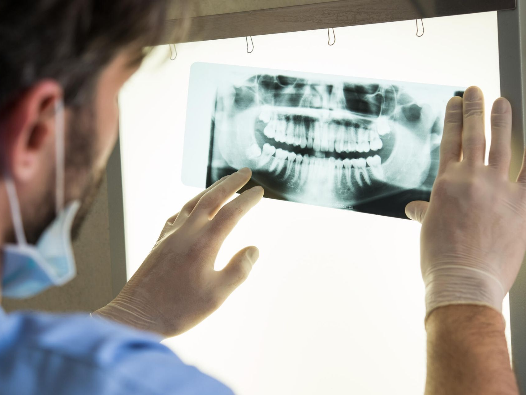 Dentist in scrubs and gloves examining dental X-ray of teeth on a light board.