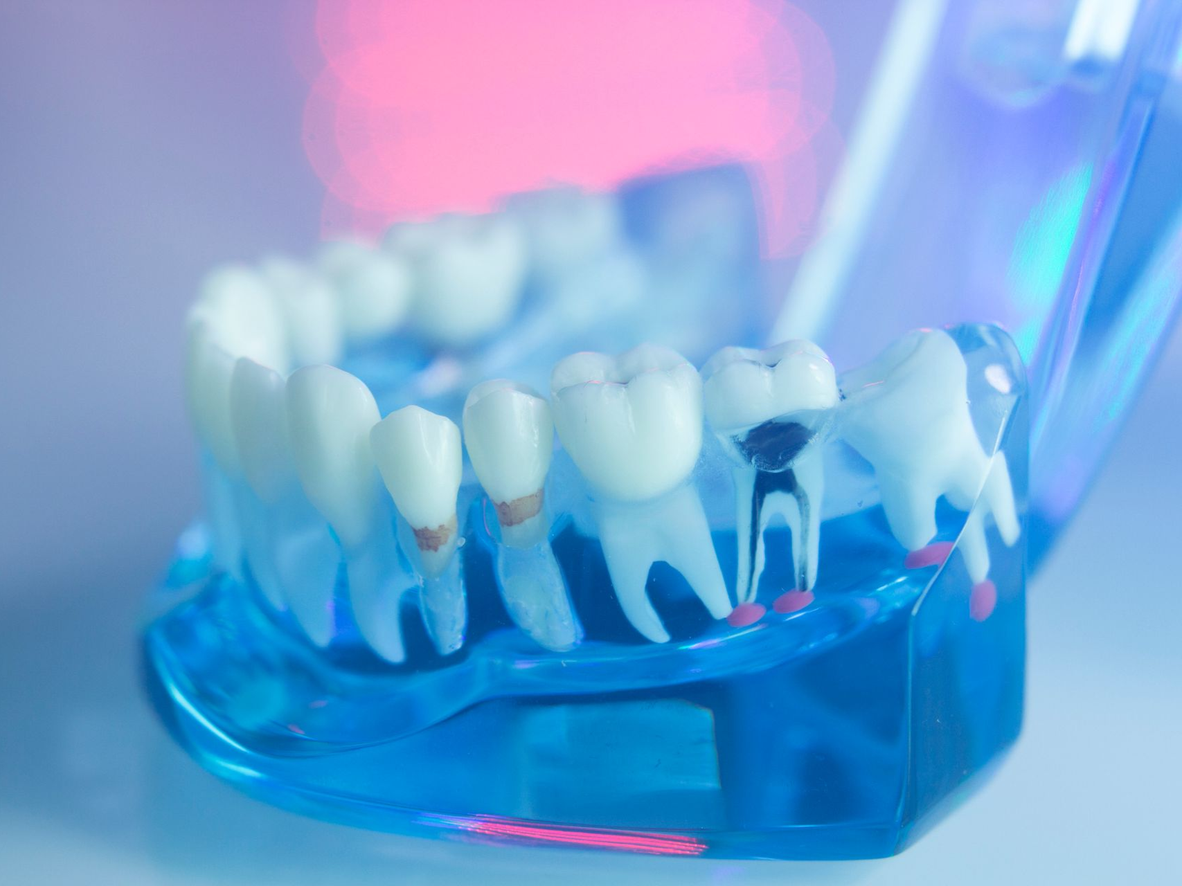 Model of teeth in jaw, showing dental work and anatomy, in blue light.