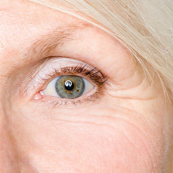 Wrinkles — Metairie, LA — Dr. Carter D. Paddock