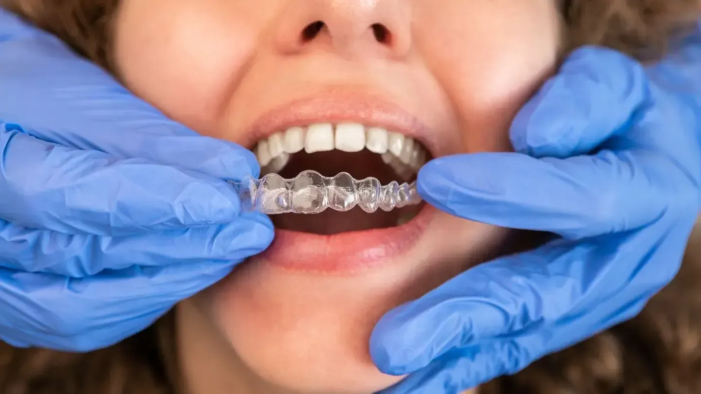 A woman is getting her teeth straightened by a dentist.