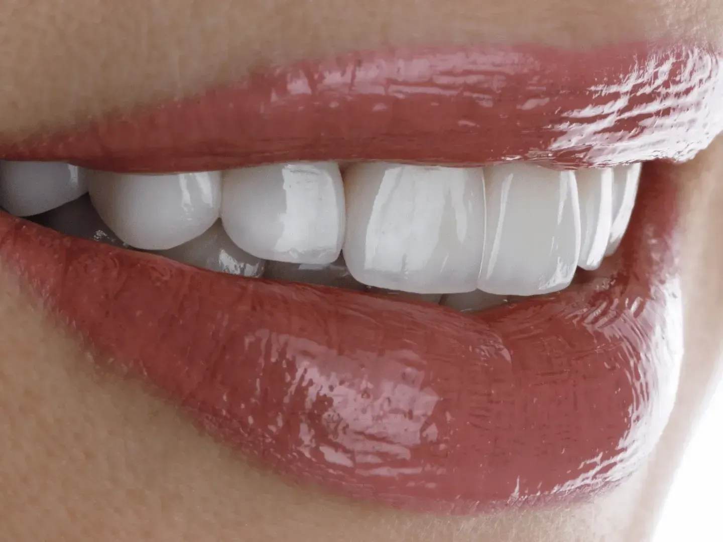 A close up of a woman 's mouth with white teeth and red lips and dental veneers