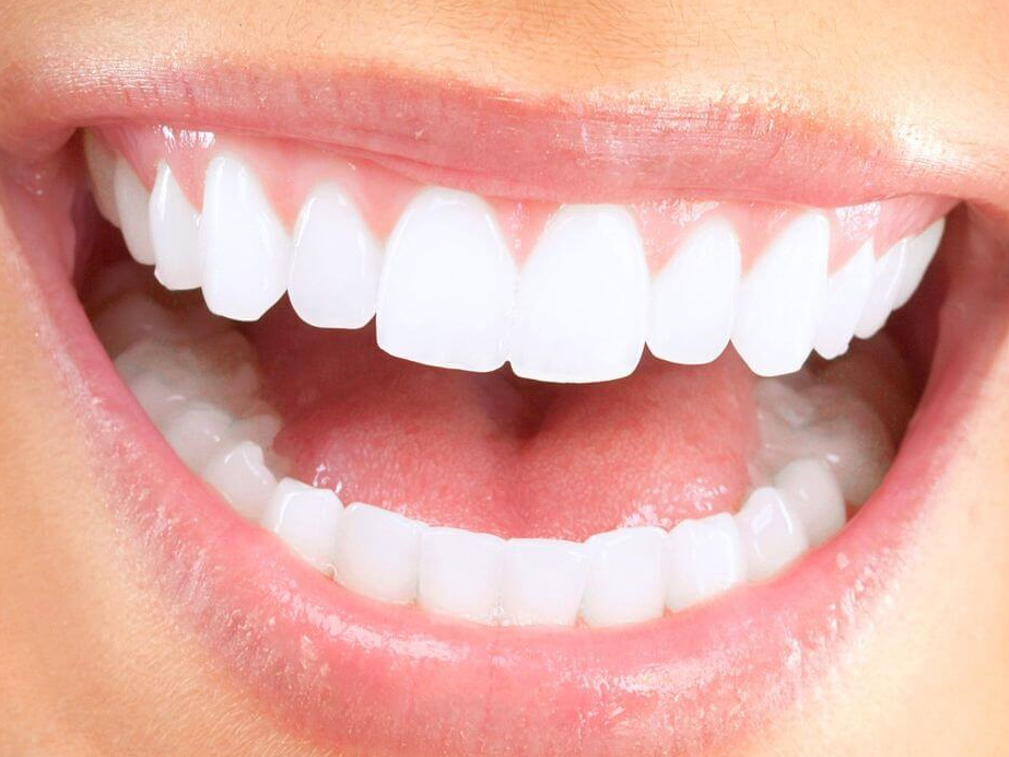 a close up of a woman 's mouth with white teeth