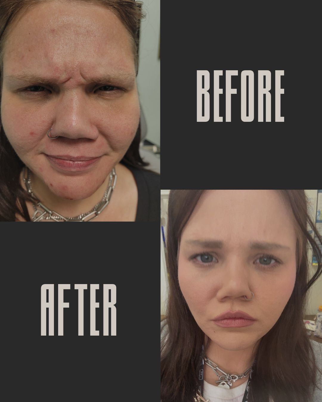 Comparison of a person's face before and after a procedure. 