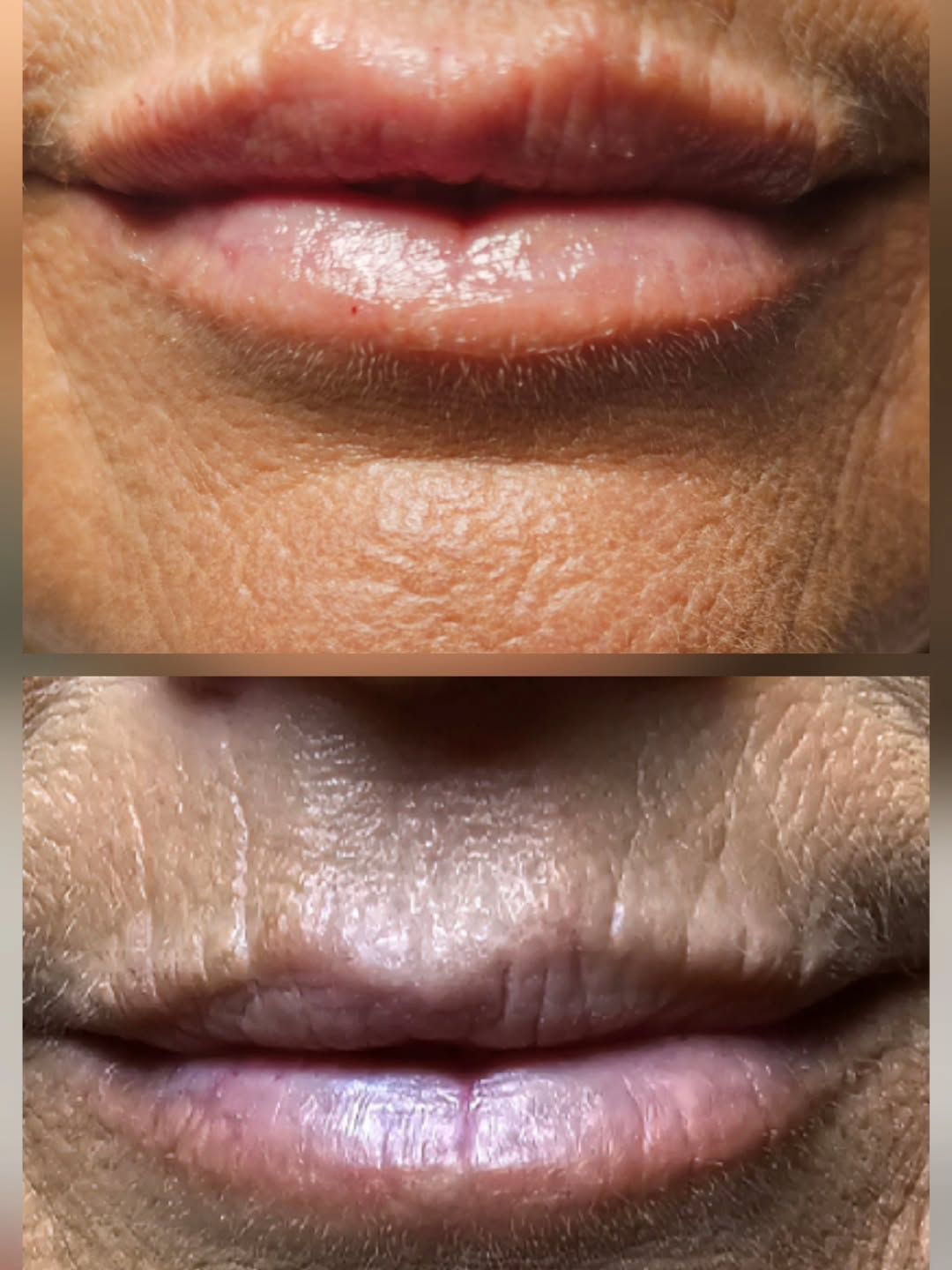 Close-up of human lips, top image is pinker than the bottom image, both with surrounding skin texture.