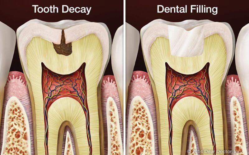 Стоматологическая терапия и эндодонтия
