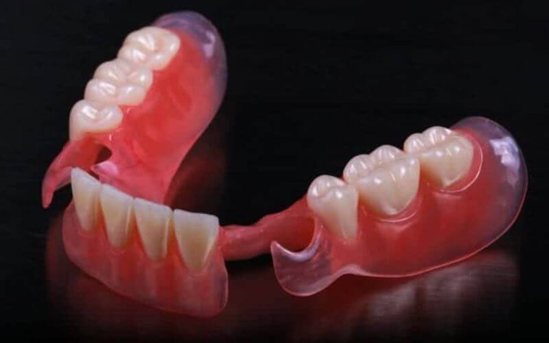Dental prosthetics