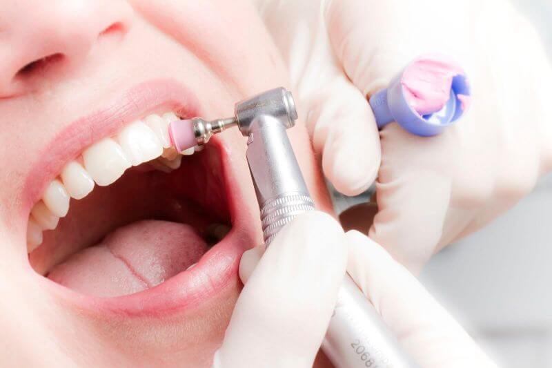 Professional oral hygiene | Dental Shop