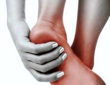 plantar fasciitis, foot, pain, arches, arch pain, painful, walking,