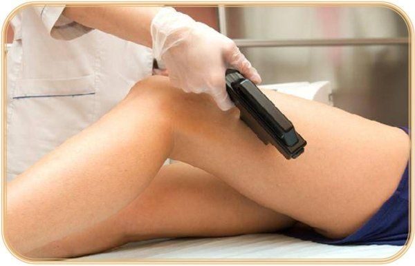 epilazione gambe con laser a diodo