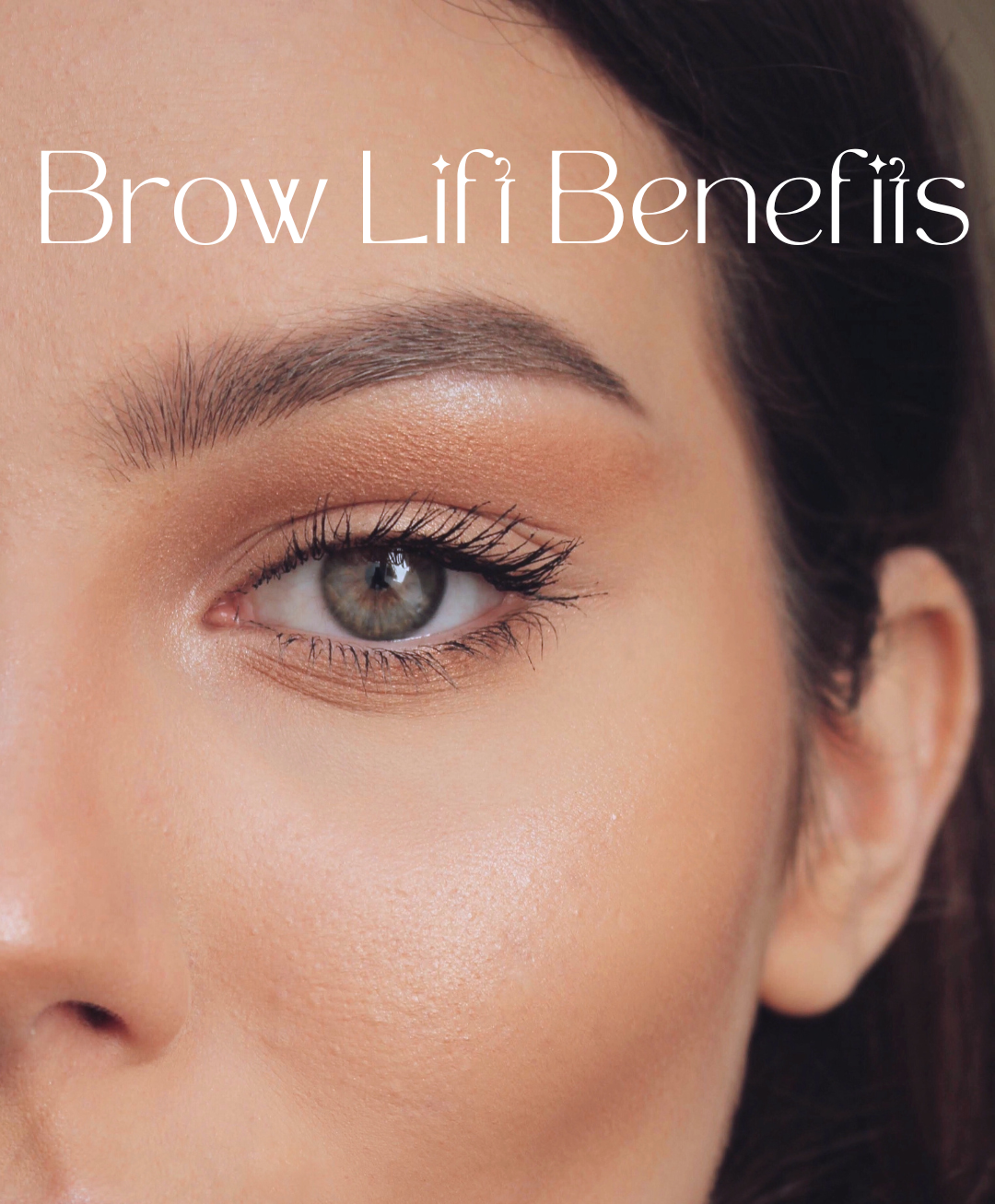 Brow lift